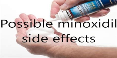 Possible minoxidil side effects - Minoxidil beard growth