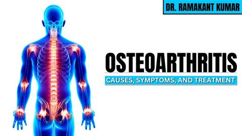 Osteoarthritis: Causes, Symptoms, and Treatment