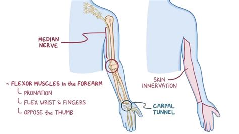 Median Nerve Palsy