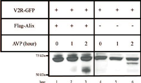 Western blot using anti-GFP antibody showing that V2R-GFP degradation ...