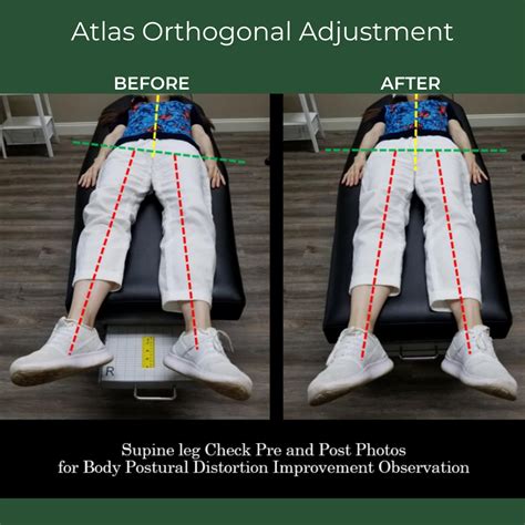 Chiropractic Adjustment Before And After