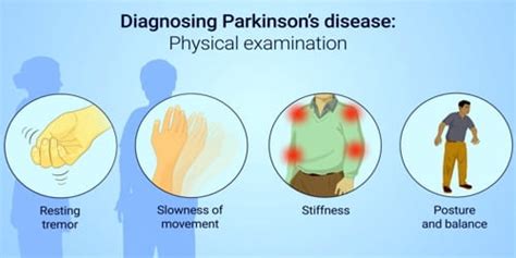 Parkinson's disease (Diagnosis, Treatment, and Preventions) - Assignment Point