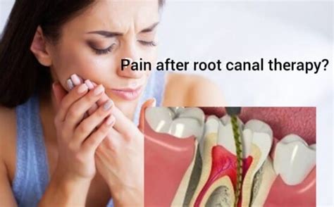 Pain after a root canal: is it normal? - Dr Atul Kakkar