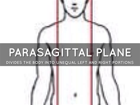 What Is The Parasagittal Plane