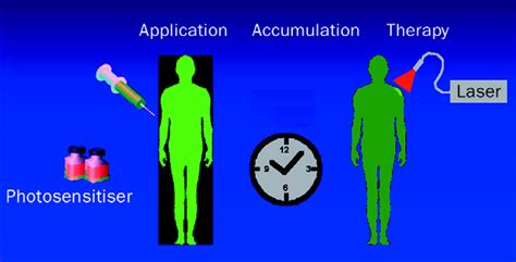 Photodynamic therapy: a clinical reality in the treatment of cancer - The Lancet Oncology