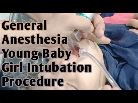 General Anesthesia Intubation Procedure | Young Baby Girl Anesthesia Intubation | Anesthetic ...