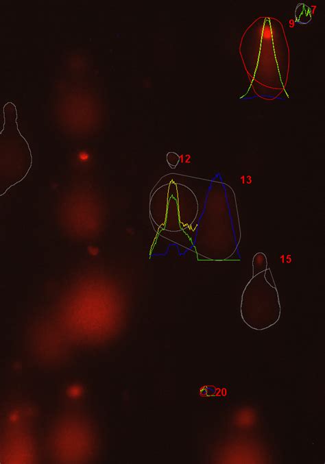 235 questions with answers in COMET ASSAY | Scientific method