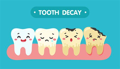 Cartoon Teeth And Gums Inside The Mouth Are Happy With The Problem Of Tooth Decay There Are ...