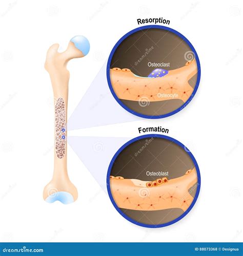 Osteocyte Cartoons, Illustrations & Vector Stock Images - 17 Pictures to download from ...