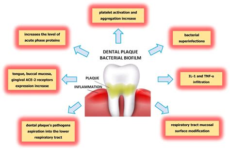 Dental Plaque Formation Stages