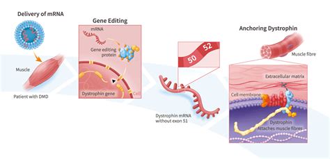 Gene-Editing Therapies for Duchenne Muscular Dystrophy (DMD) – Factor Bioscience