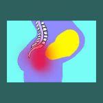 Pregnancy Sacroiliac Pain - Sacroiliac Joint Pain