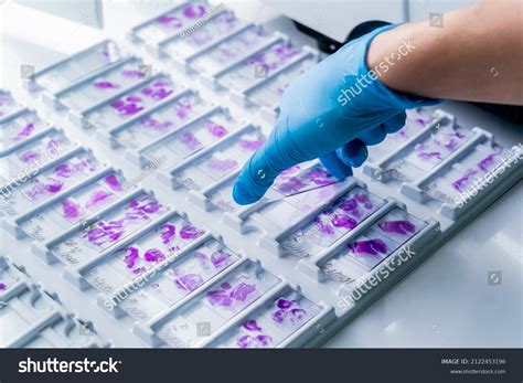 Hand Blue Glove Holding Glass Histology Stock Photo 2122453196 | Shutterstock