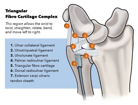 [Figure, Triangular Fibro Cartilage Complex Contributed by Katherine ...