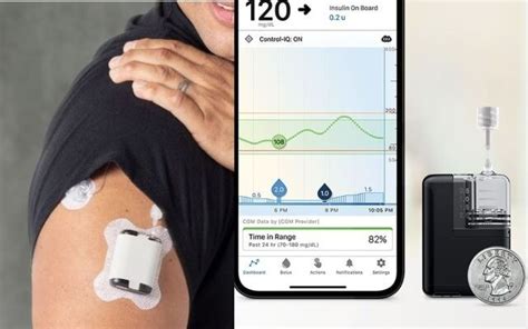 Automated Insulin Delivery Wearables : Tandem Mobi