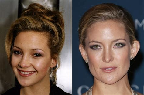 Celebrity Nose Jobs - Before & After - Mirror Online