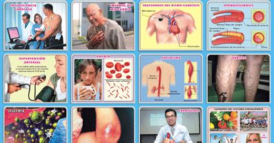 Nº 213: ENFERMEDADES DEL SISTEMA CIRCULATORIO | Sistema circulatorio ...