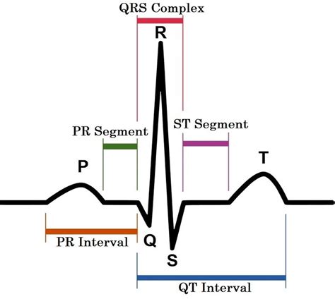 Image of one complete ECG waveform | Download Scientific Diagram