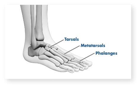 Foot Pain – Common Causes and Symptoms | Stryker