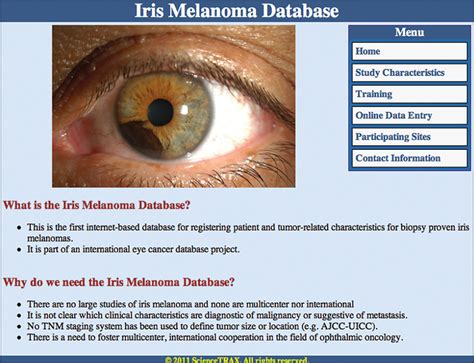 Internet entry page for the Iris Melanoma Database. | Download Scientific Diagram