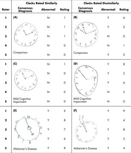 Clock Drawing Test Results - DRAWINGS OF LOVE