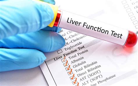 Why Should You Take The Liver Panel? | Liver Diseases | mfine