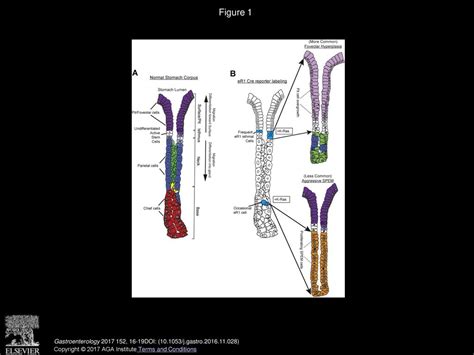 Volume 152, Issue 1, Pages (January 2017) - ppt download