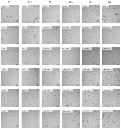 Micrographs of oil-in-water emulsions obtained with the optical... | Download Scientific Diagram