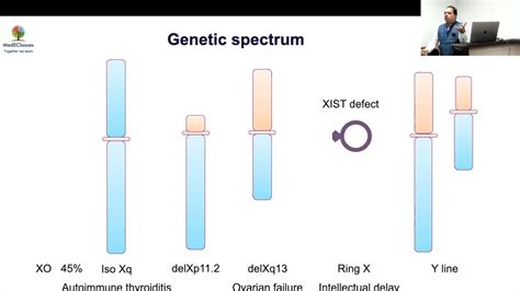 Turner syndrome genetics - YouTube