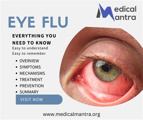 Eye Flu: Causes, Symptoms, Treatment, Prevention, and Medical Mechanism - Medical Mantra