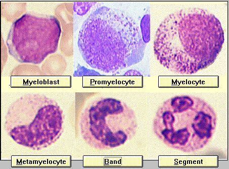 Myelocyte Vs Promyelocyte - - Yahoo | Hematología, Microbiología, Bioquímica