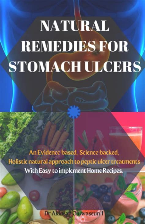 NATURAL REMEDIES FOR STOMACH ULCERS: An Evidence-based, Science-backed ...