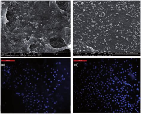 Morphology of HaCaT cells after three days of culture at 5000Â: (a) COL ...