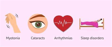 Steinert's myotonic dystrophy - Symptoms, diagnosis and treatment