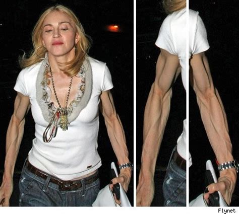 madonna | Plastic surgery photos, Madonna, Plastic surgery