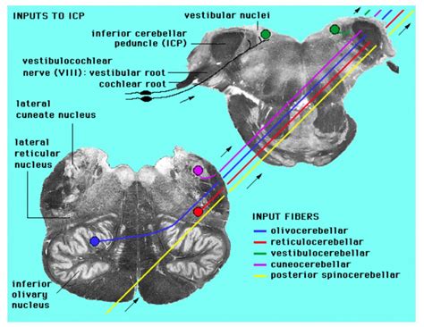 Lab Week 7: Basal Ganglia and Cerebellum – Rehab 551 Lab