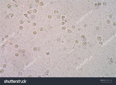 Urine Microscopic Bacteria