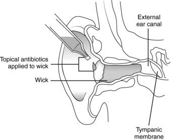 21: Otic Procedures | Nurse Key