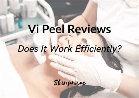 Vi Peel Review | True to its claims? - Collagen Mentor