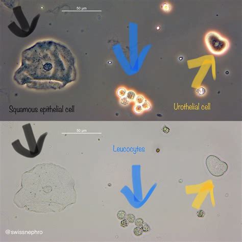 Epithelial Cells Under Microscope