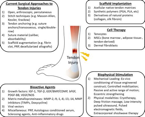 Tendon & Ligament Repair - Community and Side Projects - Sapien Medicine