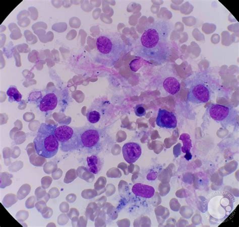 Histiocytes in normal bone marrow