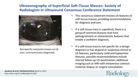 Soft Tissue Masses Radiology Key | Hot Sex Picture