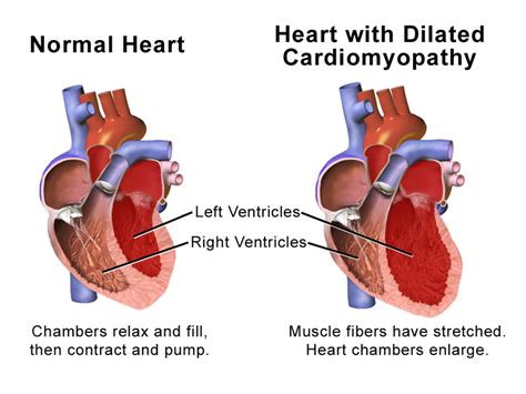 Can A Heart Murmur In A Dog Cause Death