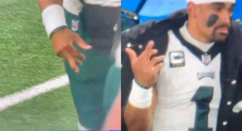 Jalen Hurts' Finger Pops Out Of Place During Gruesome Injury vs Giants ...