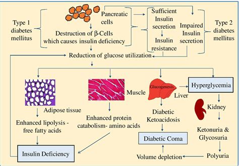 Describe the Pathophysiology of Type 1 Diabetes Mellitus - Sullivan-has ...