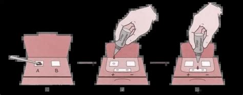 Fecal Occult Blood Test : Methods, Principle, Procedure, Clinical ...