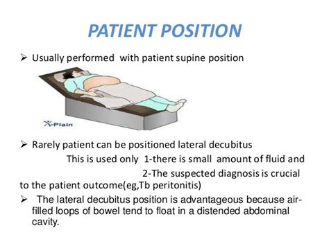 Abdominal paracentesis