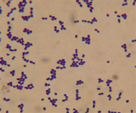 Figure 1.4 from OF CHROMOSOMAL AND PLASMID DNA PROFILES OF Lactococcus lactis ssp . lactis ...