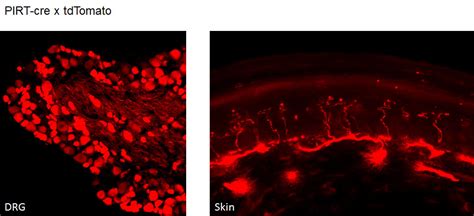 Transgenic Cre or other reporter lines for specific labeling of sensory ...